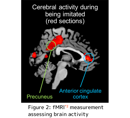 Figure 2: fMRI measurement assessing brain activity