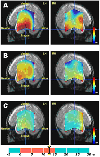 Neonate brain activity images