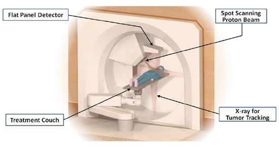 [Computer graphic] : the proposed Molecular-Tracking Radiotherapy System
