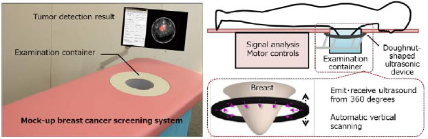 [image]Fig. 1 Breast cancer screening system mock-up and prototype configuration