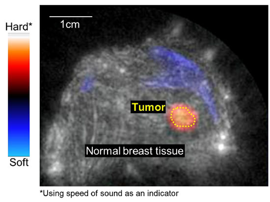 [image]Fig. 2 Detection of tumor detection in dog breast tissue using ultrasound