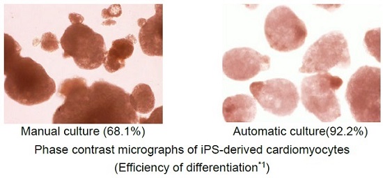 [image]Phase contrast micrographs of iPS-derived cardiomyocytes (Efficiency of differentiation*1),(left)Manual culture (68.1%),(right)Automatic culture(92.2%)