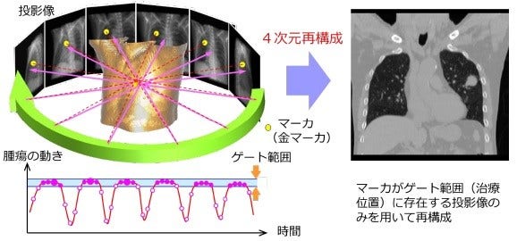 [画像]図1. 4次元CBCTの概要