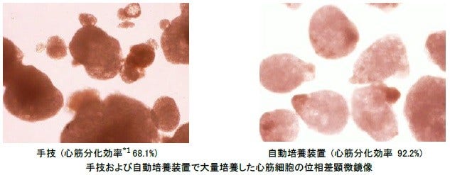 [画像]手技および自動培養装置で大量培養した心筋細胞の位相差顕微鏡像、(左)手技 (心筋分化効率*1 68.1%)、(右)自動培養装置 (心筋分化効率 92.2%)