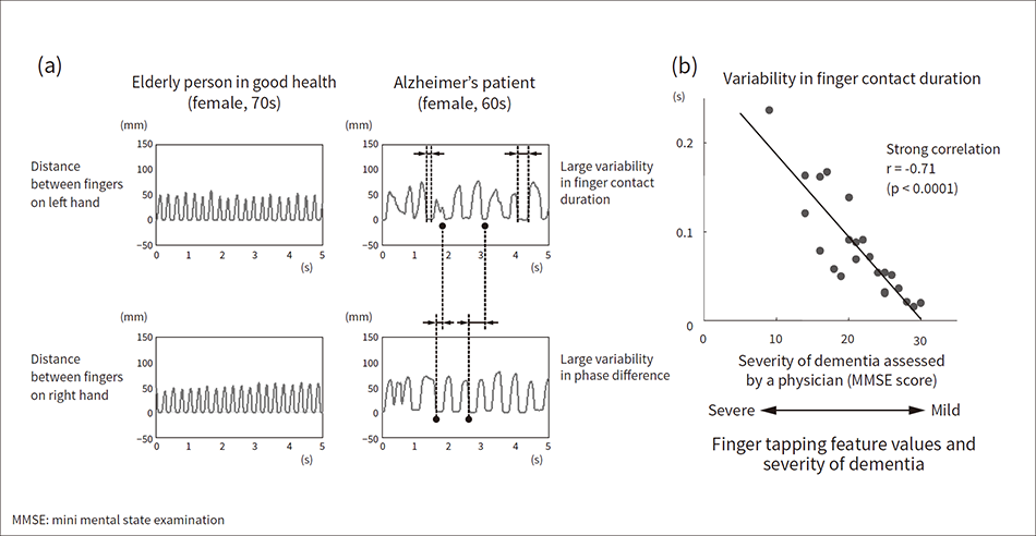 Figure 7 — Results of Finger Motion Analysis of Dementia Patients